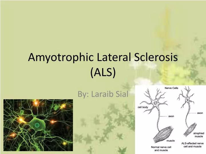 amyotrophic l ateral sclerosis als