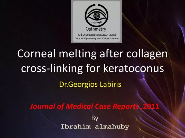 corneal melting after collagen cross linking for keratoconus