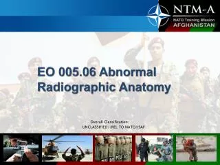 EO 005.06 Abnormal Radiographic Anatomy
