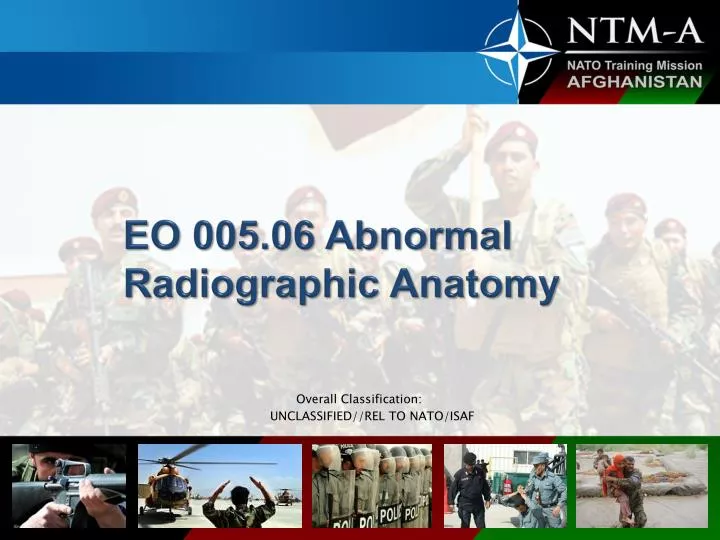 eo 005 06 abnormal radiographic anatomy