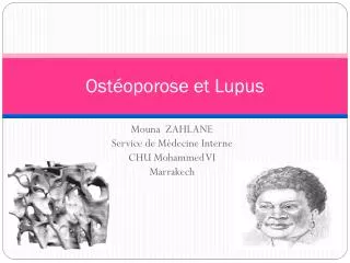 ost oporose et lupus