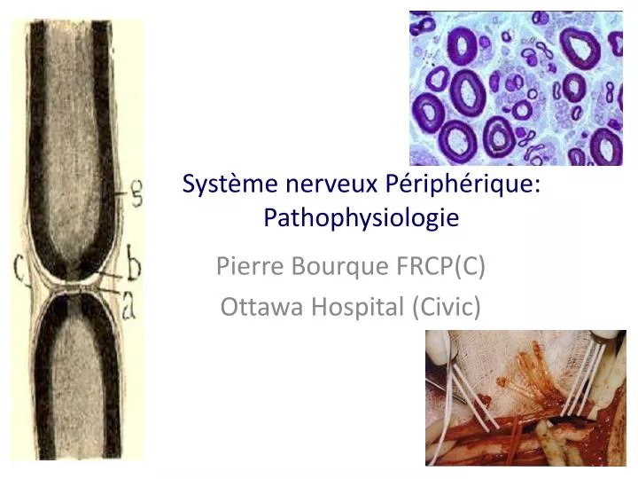 syst me nerveux p riph rique pathophysiologie