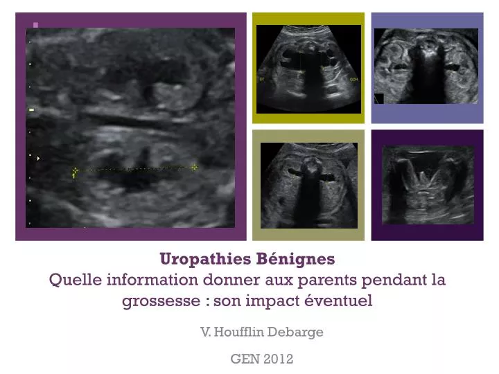 uropathies b nignes quelle information donner aux parents pendant la grossesse son impact ventuel