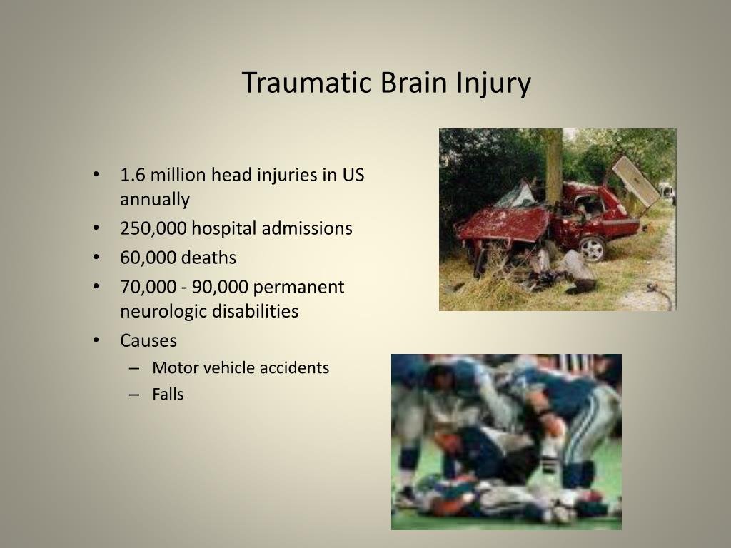 PPT - Traumatic Brain Injury PowerPoint Presentation, free download ...