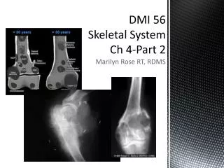 DMI 56 Skeletal System Ch 4-Part 2