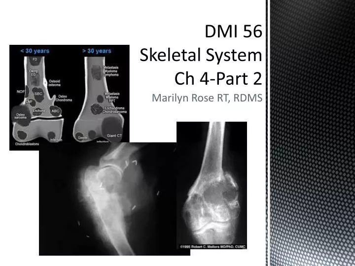 dmi 56 skeletal system ch 4 part 2