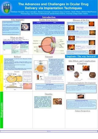 The Advances and Challenges in Ocular Drug Delivery via Implantation Techniques