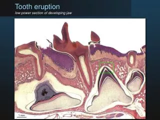 Tooth eruption low power section of developing jaw