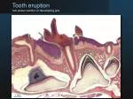 Tooth eruption low power section of developing jaw
