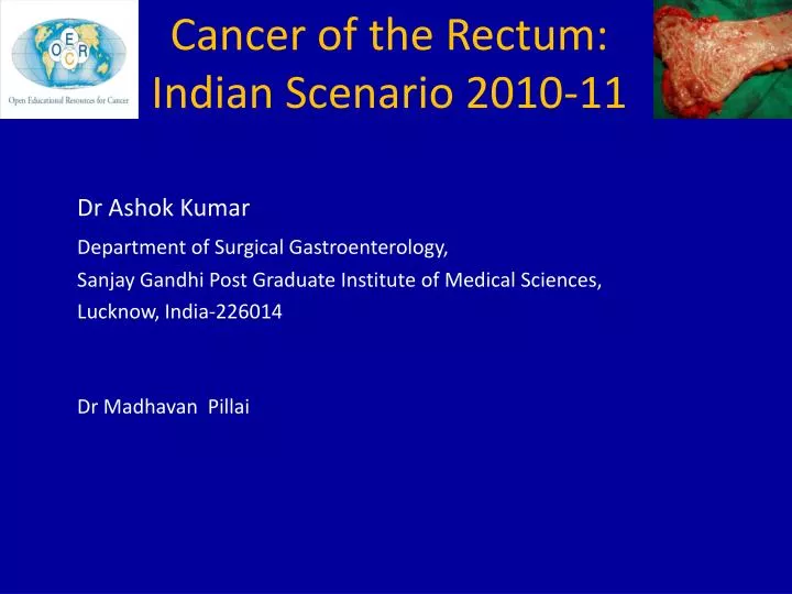cancer of the rectum indian scenario 2010 11