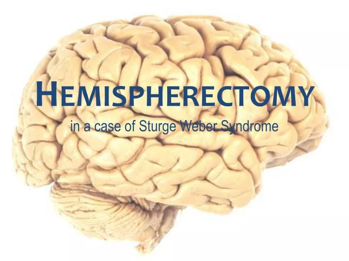 hemispherectomy in a case of sturge weber syndrome