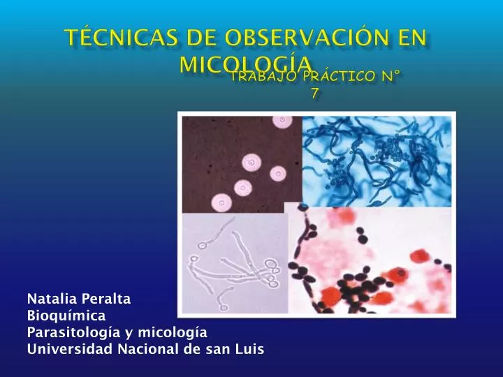 t cnicas de observaci n en micolog a