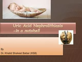 Uric Acid Nephrolithiasis -in a nutshell