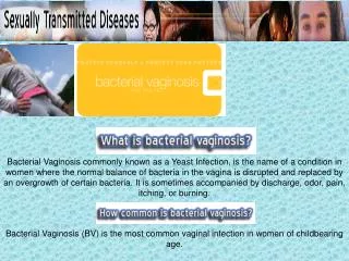 Bacterial Vaginosis (BV) is the most common vaginal infection in women of childbearing age.