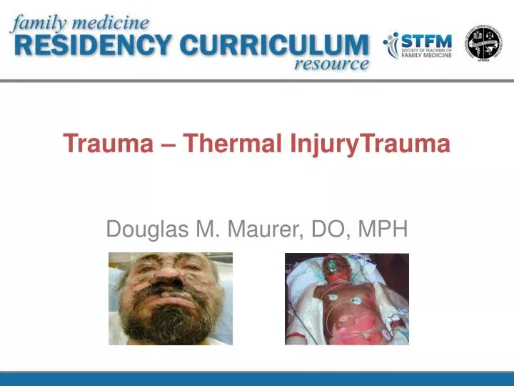 trauma thermal injurytrauma