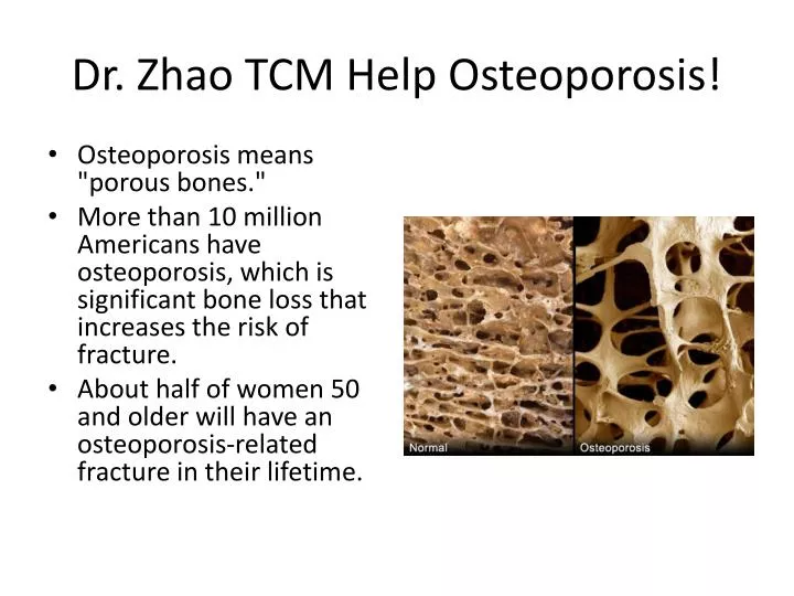 dr zhao tcm help osteoporosis