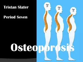 Osteoporosis