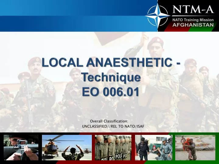 local anaesthetic technique eo 006 01