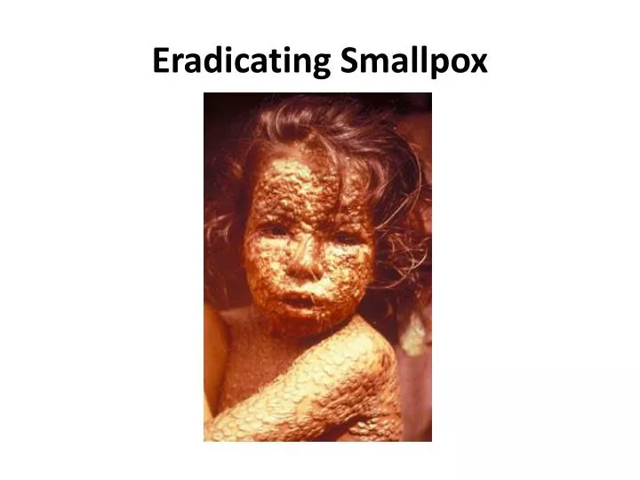 eradicating smallpox