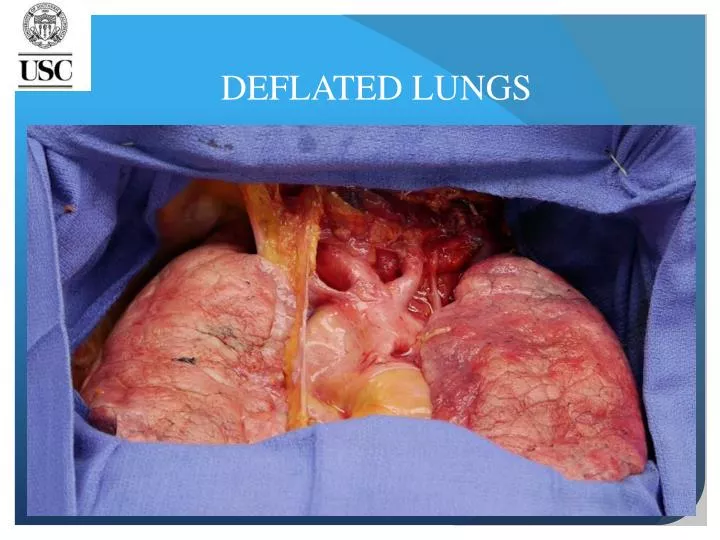 deflated lungs