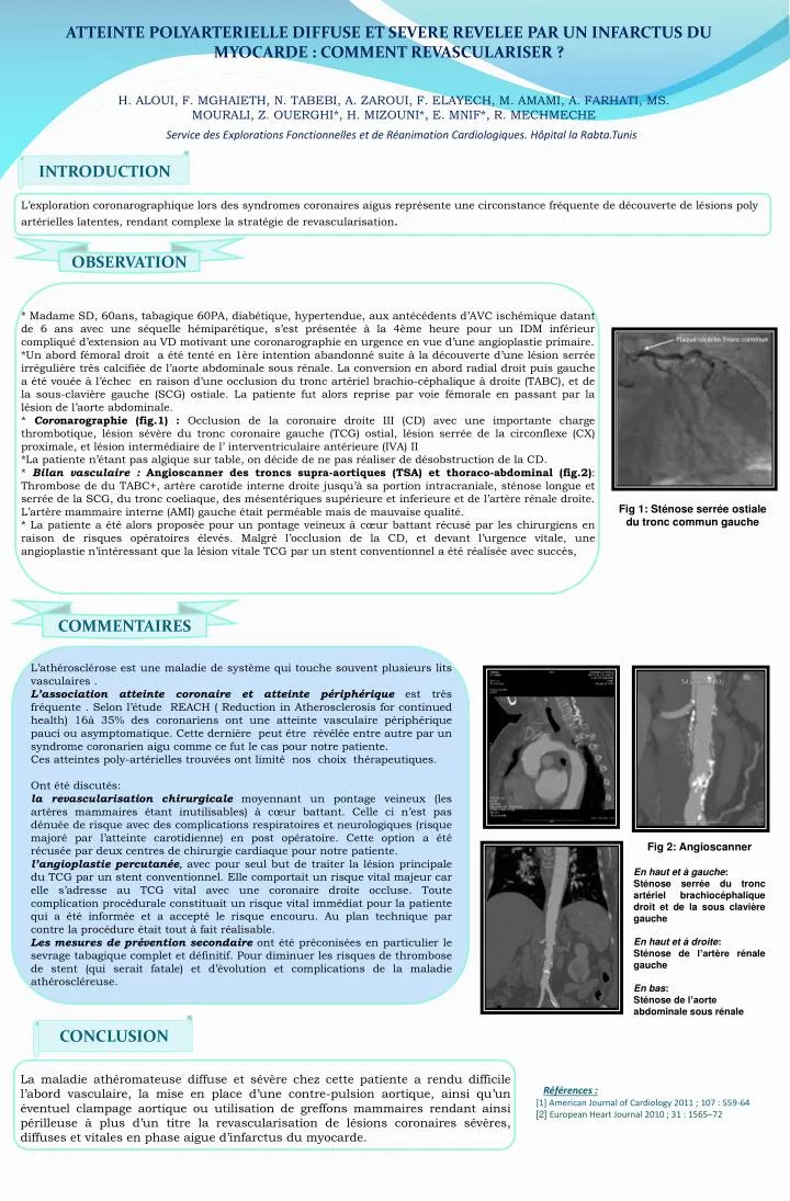 service des explorations fonctionnelles et de r animation cardiologiques h pital la rabta tunis