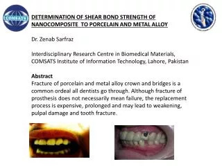 DETERMINATION OF SHEAR BOND STRENGTH OF
