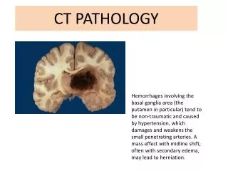 CT PATHOLOGY