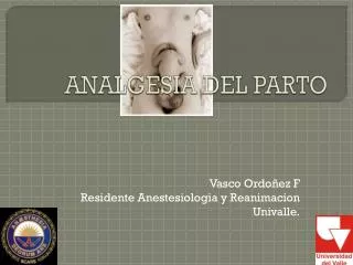 analgesia del parto
