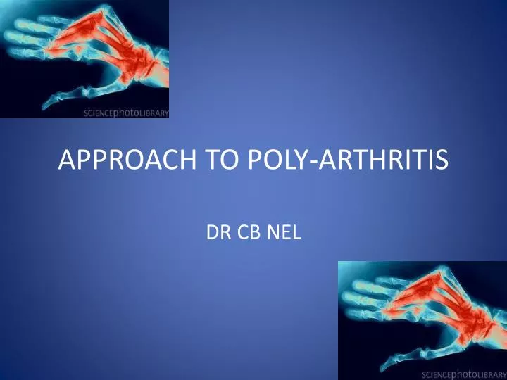 approach to poly arthritis