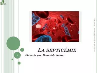 la septic mie