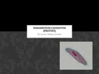 Paramecium caudatum ( Protist )