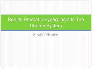 Benign Prostatic Hyperplasia In The Urinary System