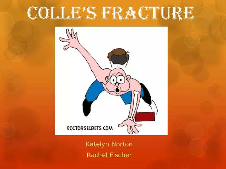 colle s fracture