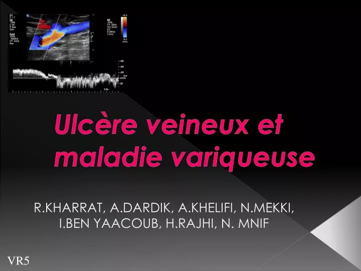 ulc re veineux et maladie variqueuse