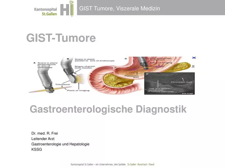 gist tumore