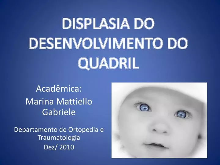 displasia do desenvolvimento do quadril