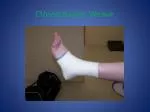 PPT - Ankle Taping Closed Basket-weave PowerPoint Presentation, free ...