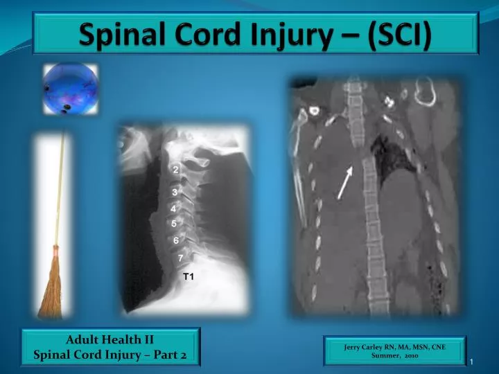 spinal cord injury sci