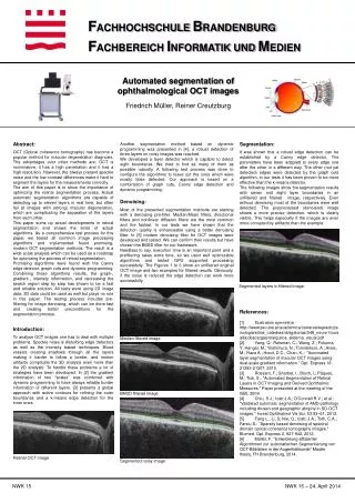Automated segmentation of ophthalmological OCT images