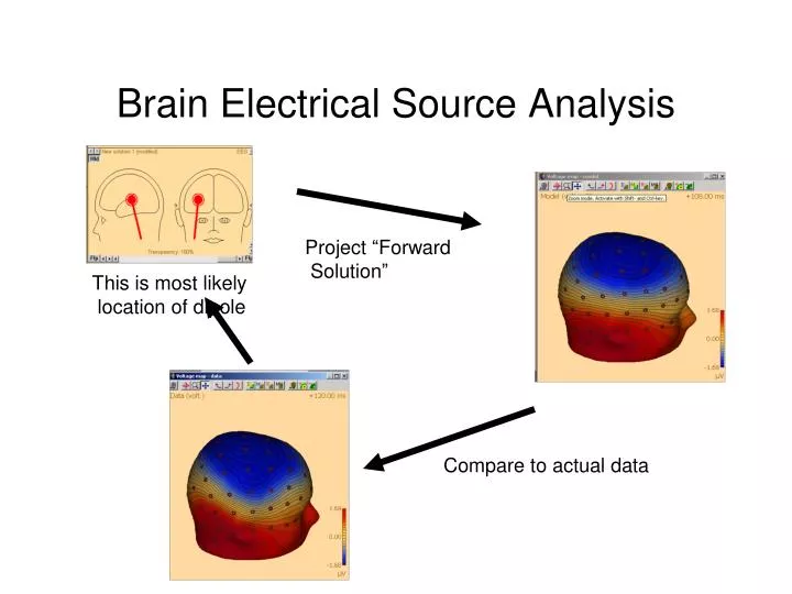 brain electrical source analysis