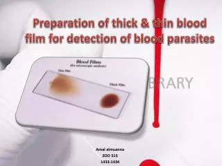 Preparation of thick &amp; thin blood film for detection of blood parasites