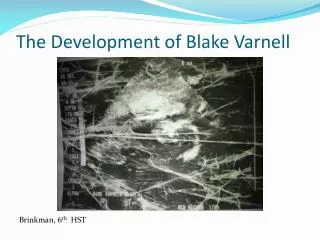 The Development of Blake Varnell