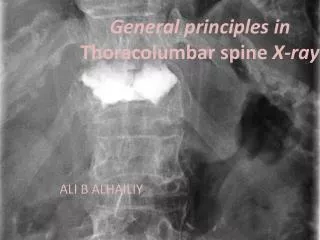 General principles in Thoracolumbar spine X-ray