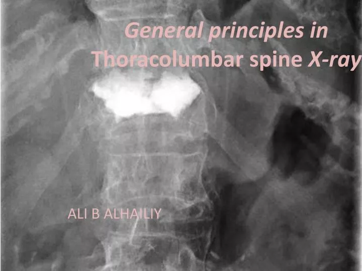 general principles in thoracolumbar spine x ray