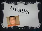 Mumps - slide 1