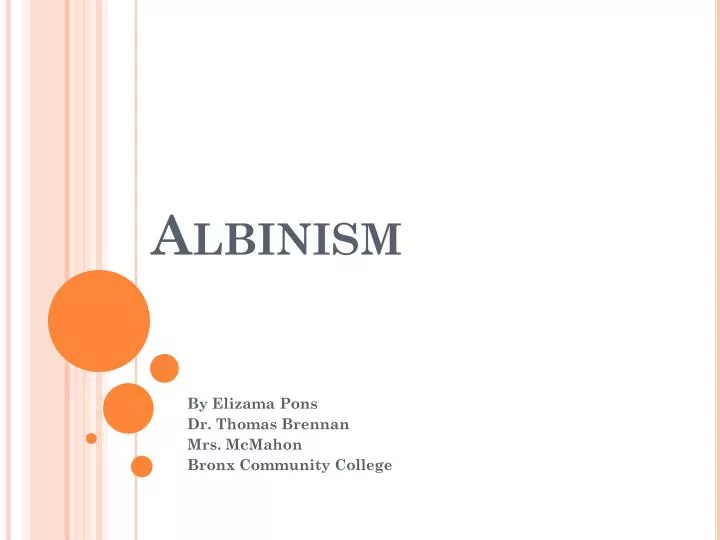 albinism