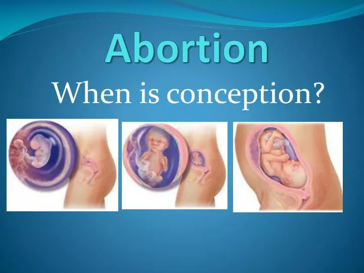 abortion