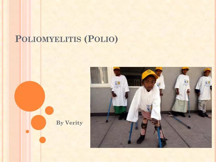 poliomyelitis polio