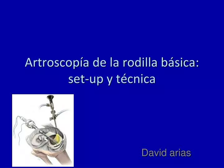 artroscop a de la rodilla b sica set up y t cnica