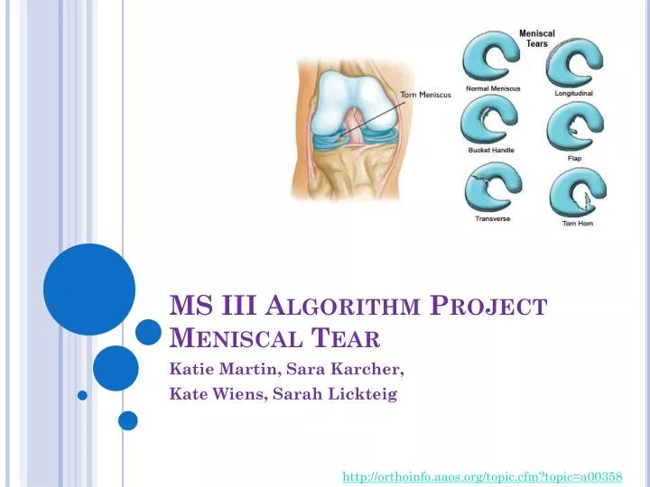 ms iii algorithm project meniscal tear